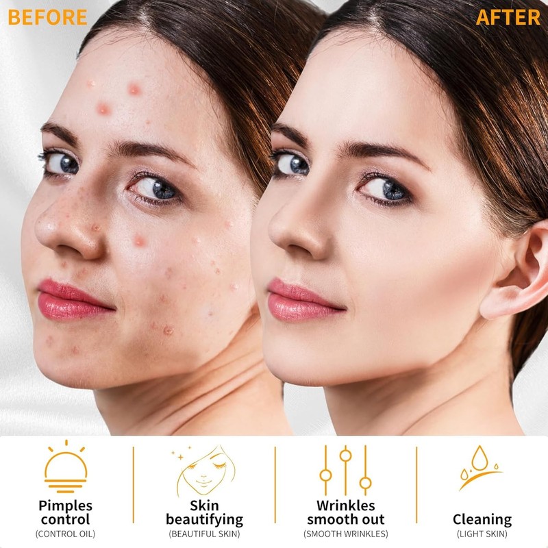High Frequency Facial Skin Care Wand Machine Acne Hair Treatment Set gallery