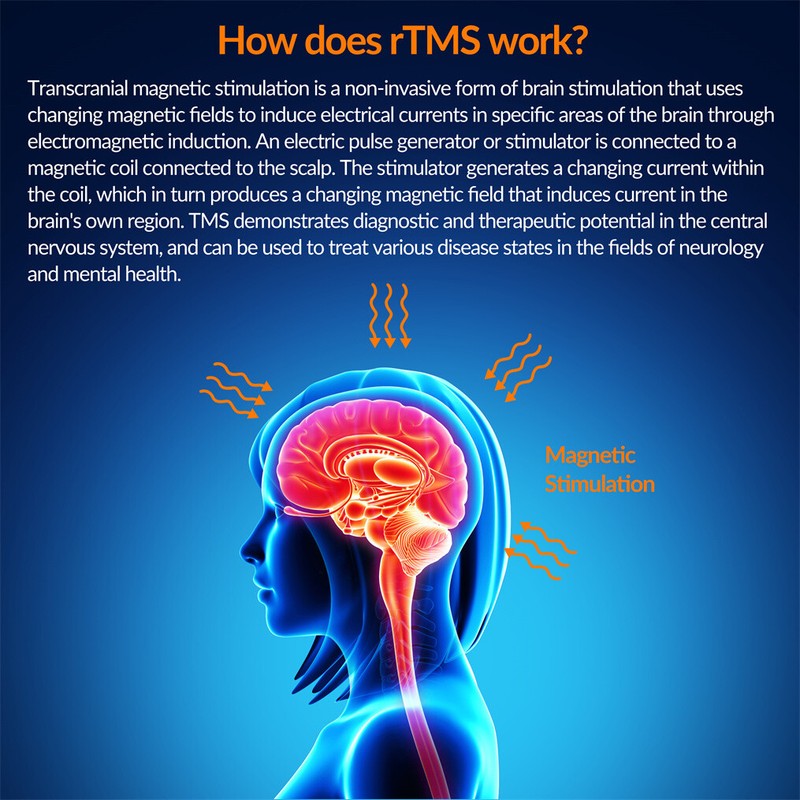 TMS Transcranial Stimulation Machine rTMS Chronic Pain Anxiety Relief Home Use gallery