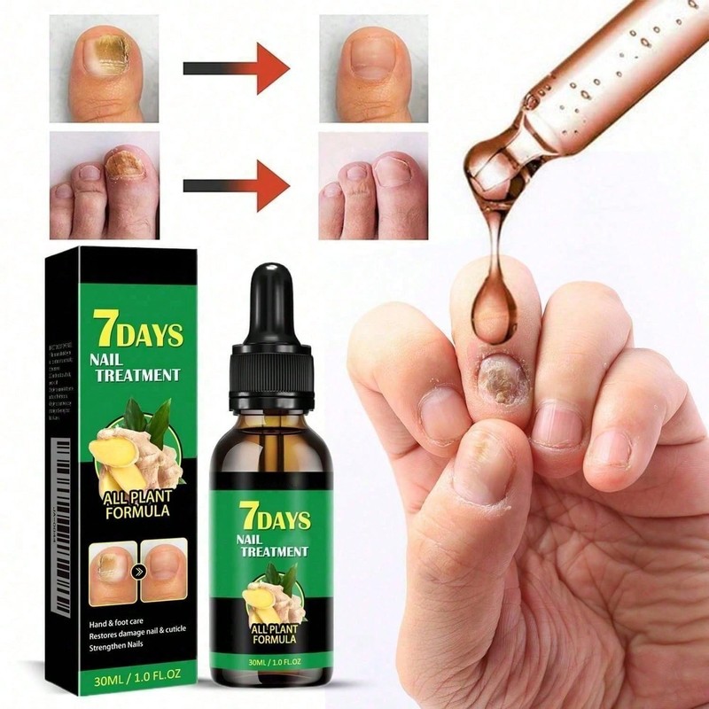 7days Toenail Fungus Treatment Ginger Nail Repair Oil Fungal Nail Repair Patches