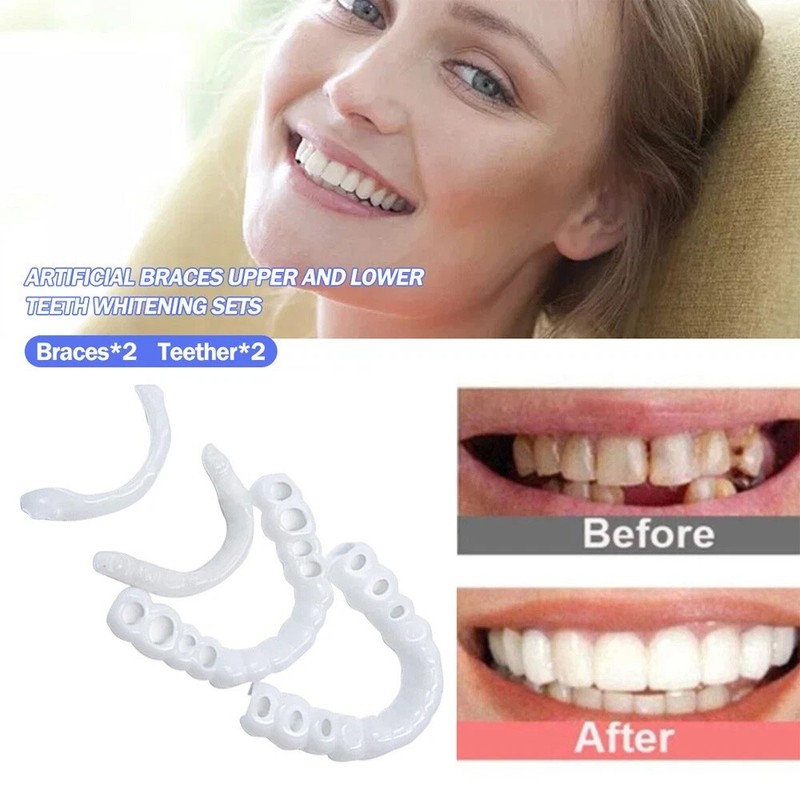 Smile Snap On Upper + Lower False Teeth Dental Veneers Denture Tooth Cover Set