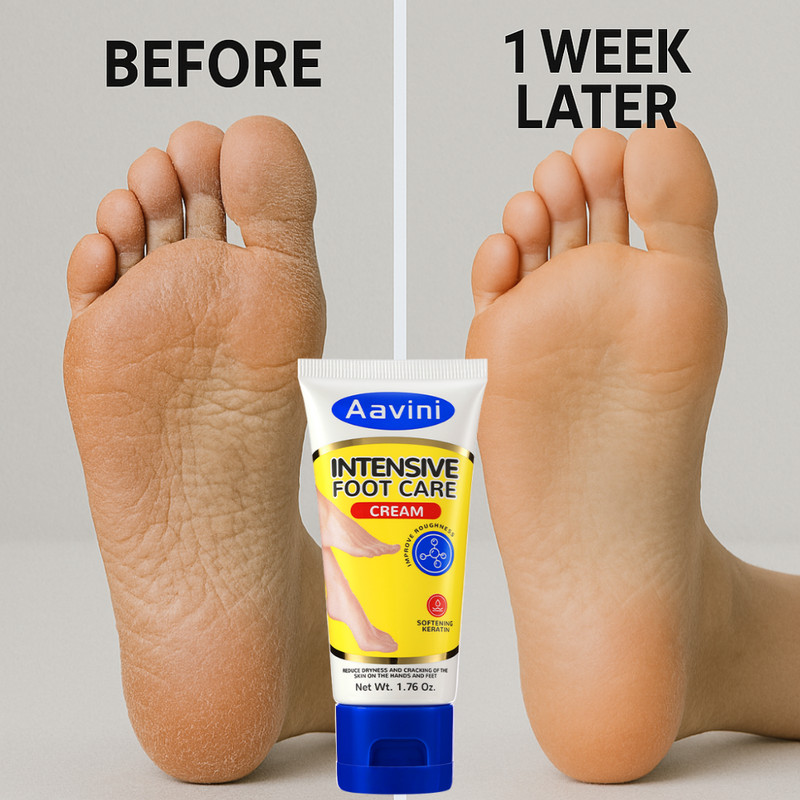 Heel Repair Cream – Smooth, Hydrate & Restore Dry Cracked Feet Quickly gallery