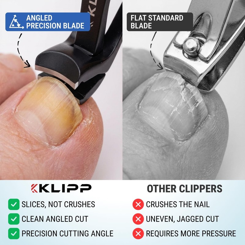 Toenail Clippers for Thick Toenails – KLIPP 15 mm Wide Jaw Thick Fingernail a... gallery