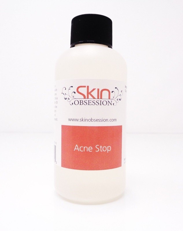 4 oz Acne Stop ~Skin Obsession~ Excellent Acne & Blemish Skin Care Product!!