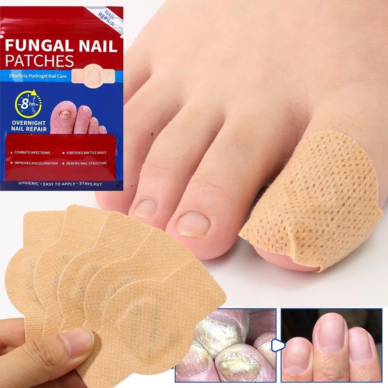 21 Pcs Fungal Nail Patches – Extra Strength Toenail Fungus Treatment Overnight