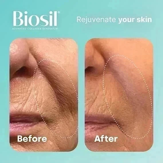 Biosil Collagen Generator - 120 Original Capsules ( pack of 2 ) gallery