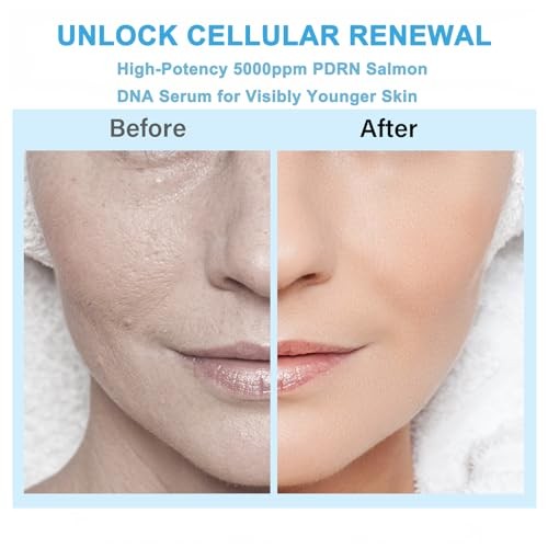 PDRN Salmon DNA Serum 5000ppm Anti-Aging Facial gallery