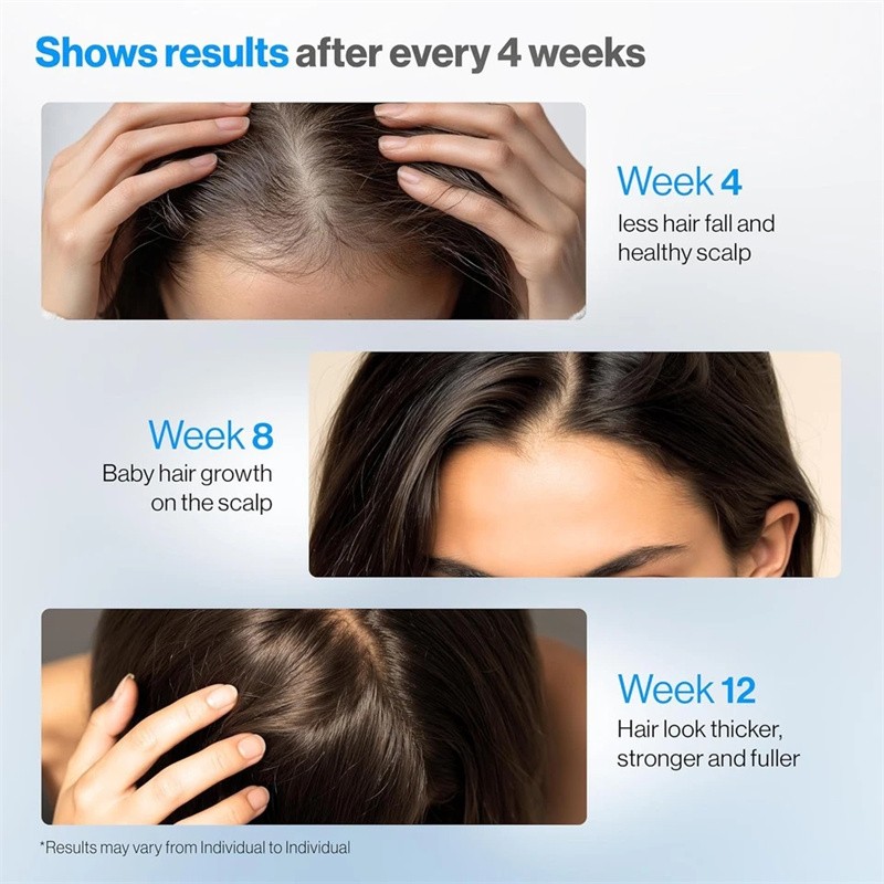 Be Bodywise Hair Growth Serum Roll-On 25ml - 3% Rosemary, Reduces Hair Fall gallery