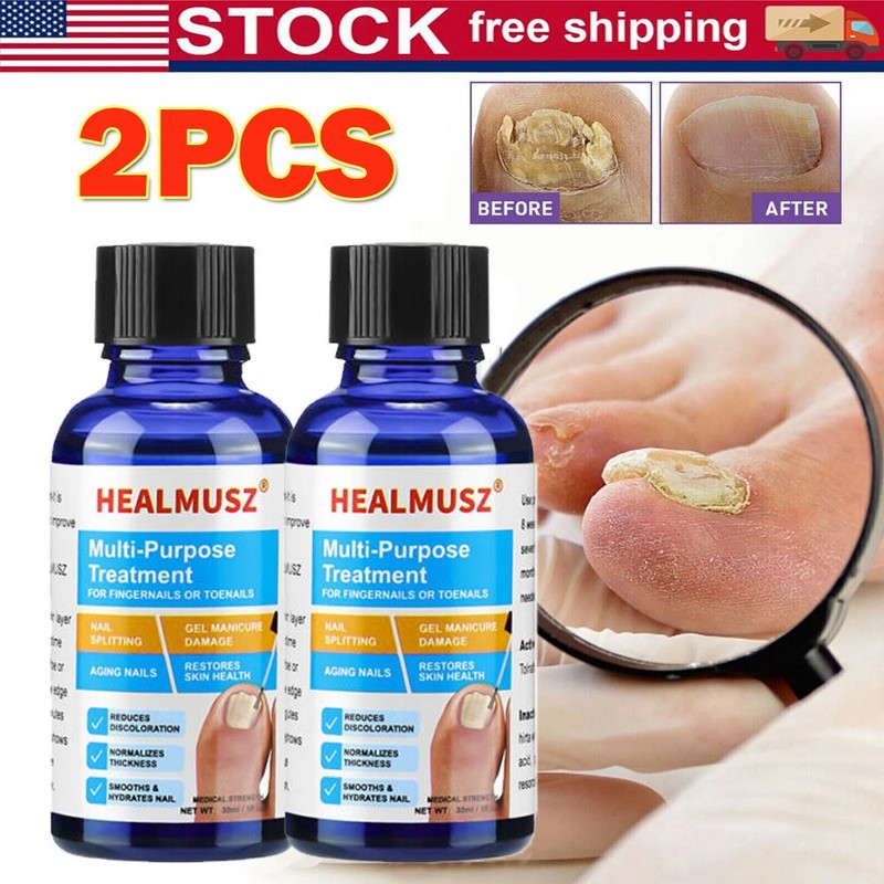 2 Pack Anti Fungal Nail Treatment Toenail Fungus Fungi Nail Repair Foot Care gallery