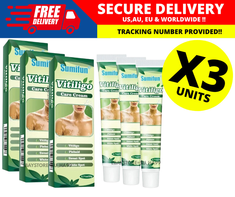 Vitiligo Treatment Ointment 20g – Fade White Spots & Pigment Loss ( X 3 )
