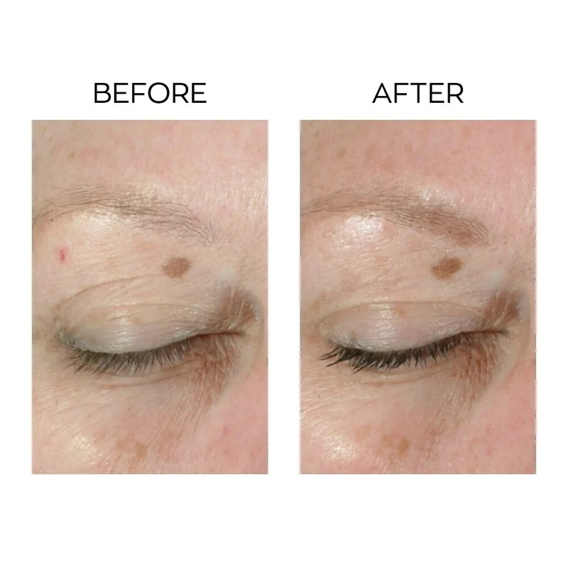 Avon Anew Lifting Dual Eye System with Protinol 20 ml / 0.66 fl oz gallery