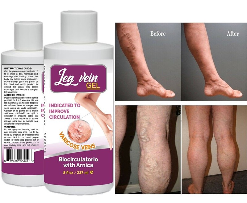 Natural Ointment Varicose Veins Vasculitis Support Foot Care Cream USA spider