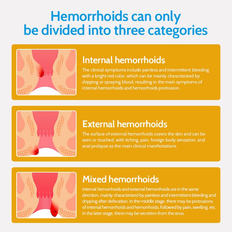2025 Natural Herbal Hemorrhoids Ointment Piles Medicine Treatment Cream Hemoroid gallery