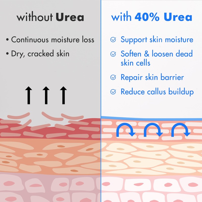 Ebanel Urea Cream 40% plus Salicylic Acid 4.6 Ounce (Pack of 1), gallery