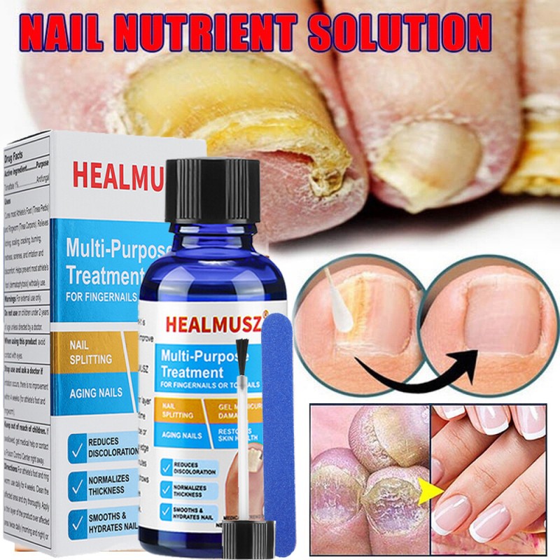 30g ANTI FUNGAL TREATMENT EXTRA STRENGTH TOENAIL FUNGUS ATHLETES FOOT FUNGI NAIL
