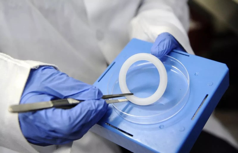 VAGINAL RING PESSARY PROLAPSE FDA APRVD - CHOOSE SIZE & QUANTITY! 3 DAY DELIVERY gallery