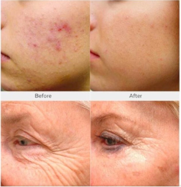 2 PK Retinol, Niacinamide Vita C Hyaluronic Acid Collagen Wrinkle SERUM + CREAM gallery
