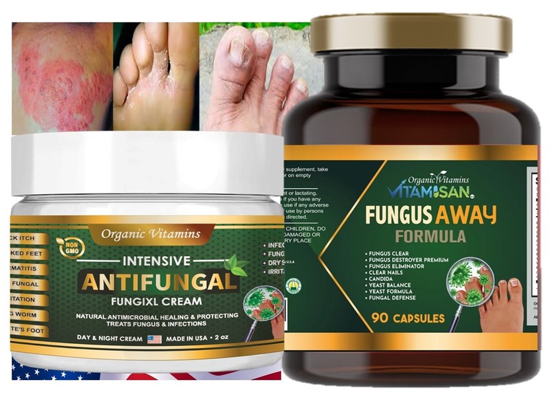 Athlete’s Foot, Ringworm, Fungal infection Medicated Skin Cream + pill stop fung
