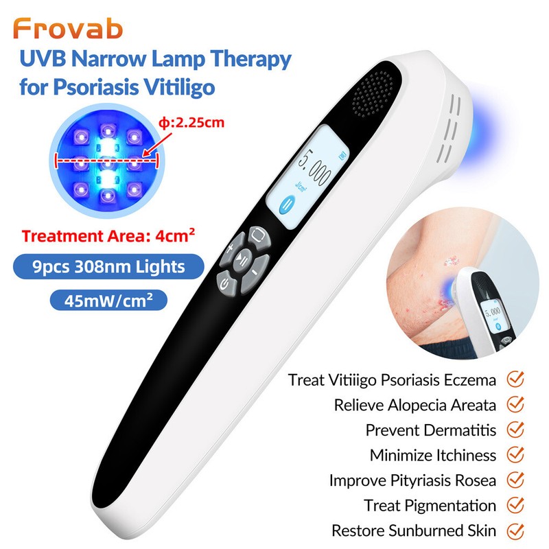 308nm Excimer Phototherapy Device Blue UV Light Therapy for Skin Disorders