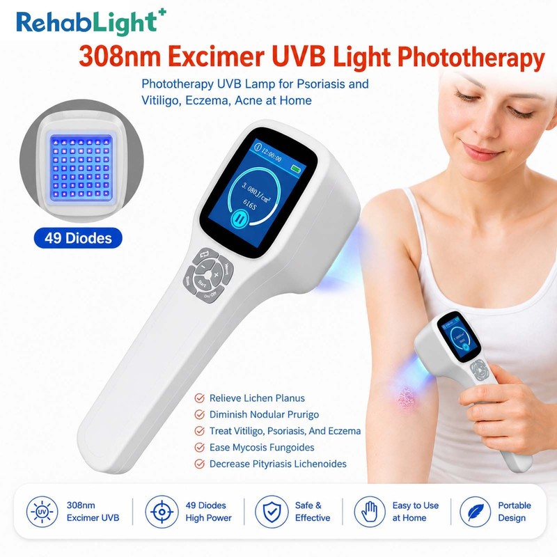 308nm UVB Light Machine with 49 Lamp Beads for Skin Wellness and Glasses Home