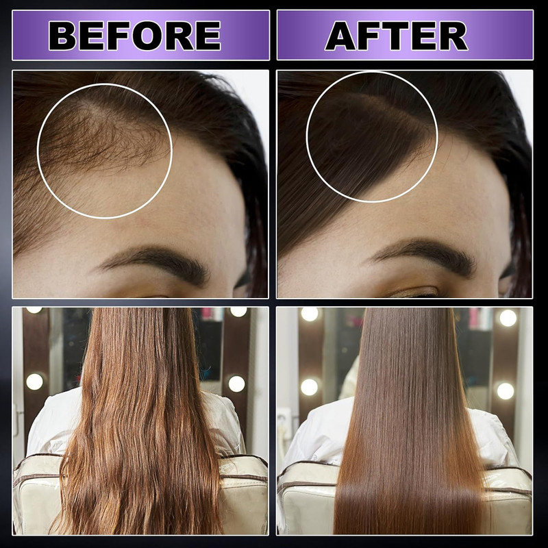 Organic Black Rice Water Hair Growth Serum Spray, 5 Fl Oz, Rosemary Scent, for A gallery