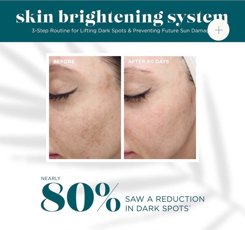 VI Peel Derm Pigment Correcting System gallery