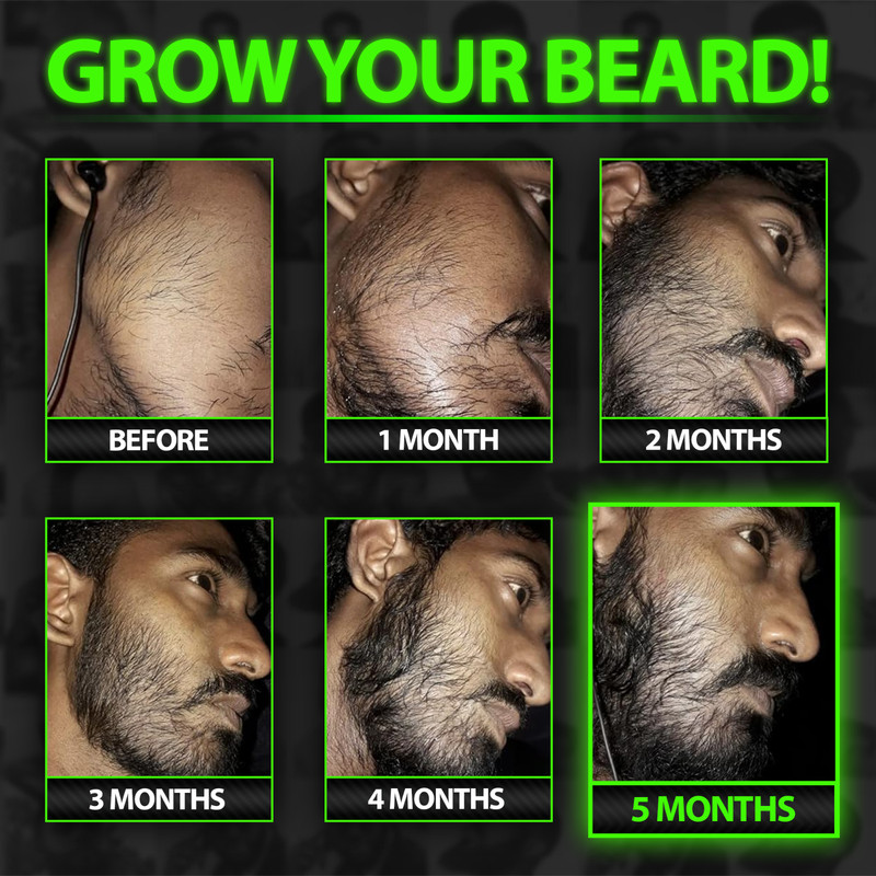 GROW MAX XXL Beard & Mustache Accelerator - #1 FACIAL HAIR GROWTH OIL WORLDWIDE! gallery