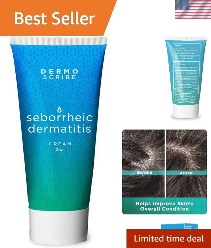 Eczema Cream for Face, Chest & Scalp – 2 oz of Hydrating Relief for Itchy Skin