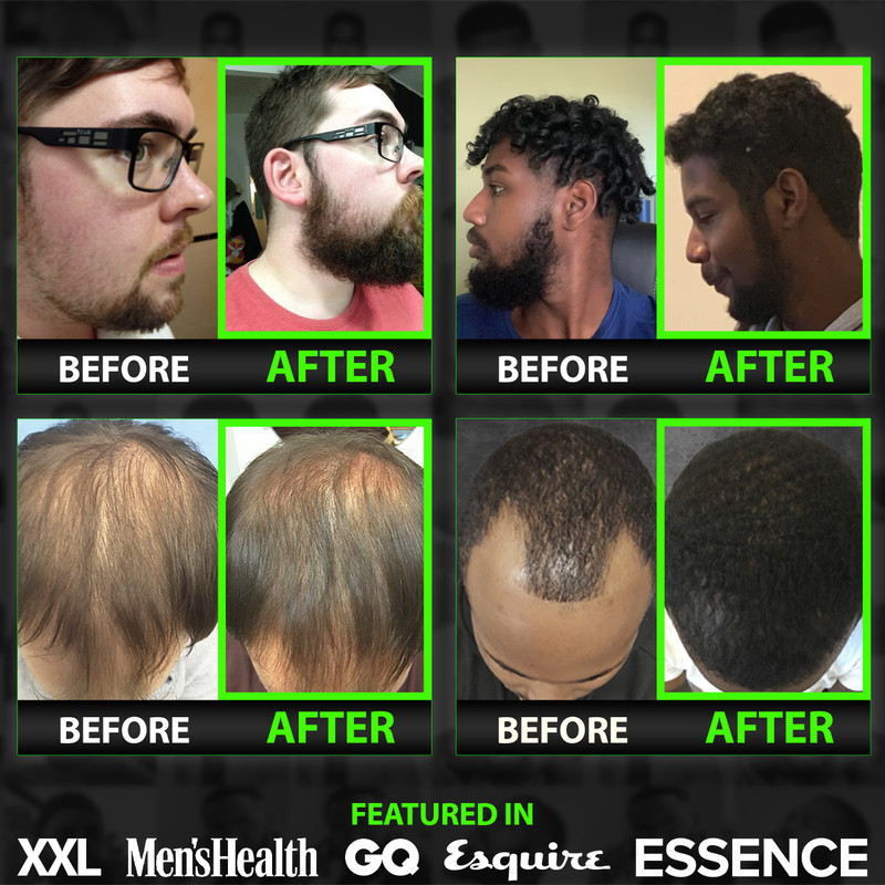 GROW MAX XXL Beard & Mustache Accelerator - #1 FACIAL HAIR GROWTH OIL WORLDWIDE! gallery