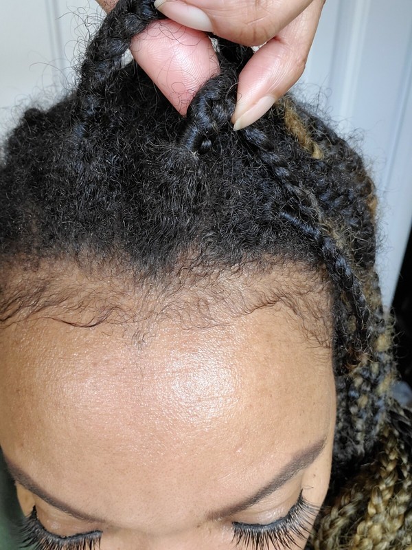 Organic Hair Growth Oil Treatment Alopecia,Bald Spots,Thinning hair Potent 1oz. gallery