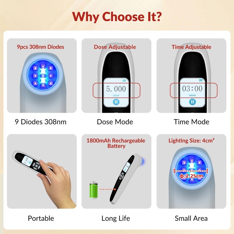 Skin Health Equipment 308nm UV Light Therapy Device 55mW/cm² Home / Office Use gallery