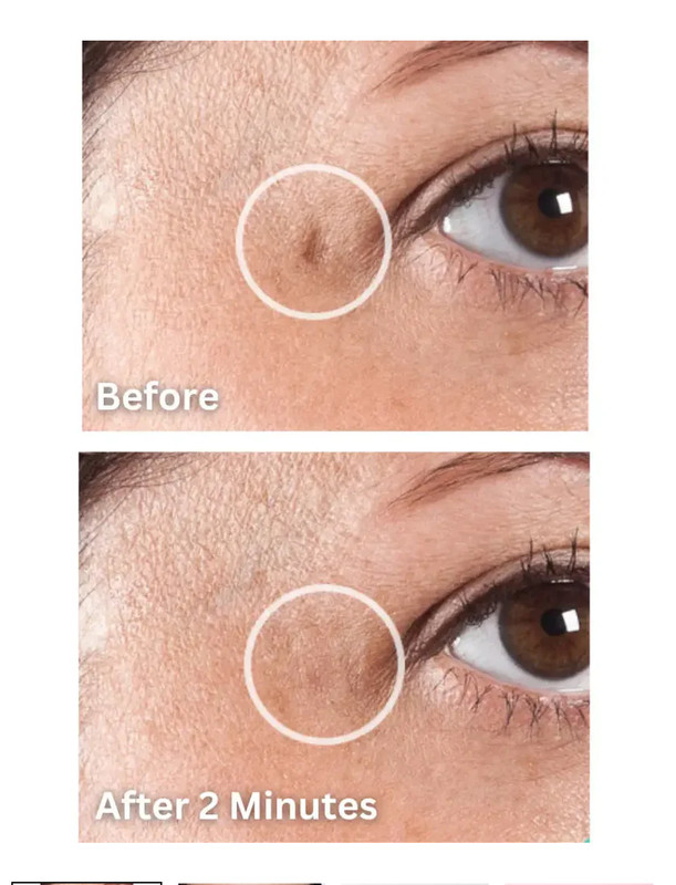 Dermaflage, The Hollywood Topical Filler Starter KIT gallery