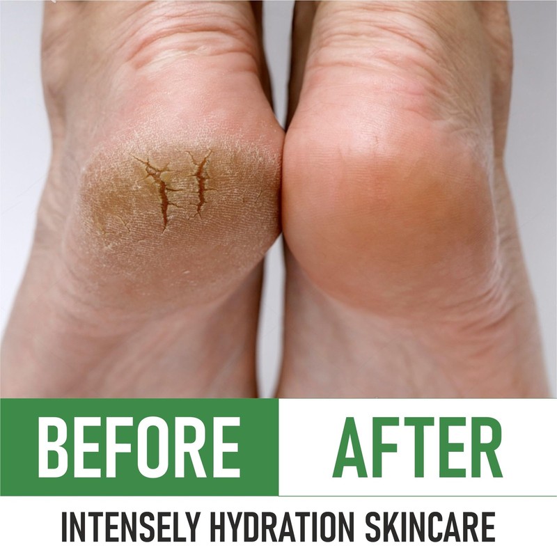 PurOrganica Urea 40% Foot Cream – Made in USA, 4 Ounce (Pack of 1), Pack 1 gallery